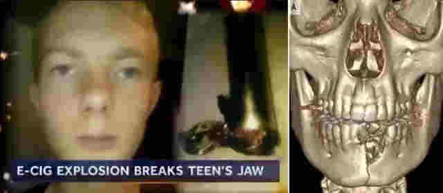 33人致死、1500人染病，如今終于禁售，電子煙“好”日子到頭 